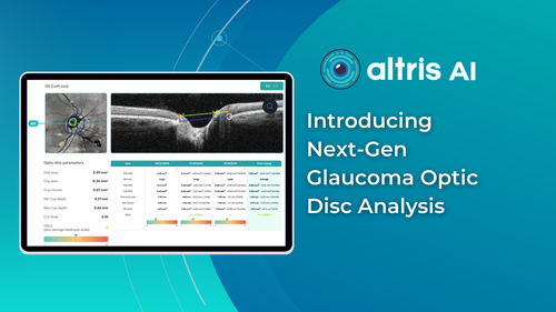 Transforming Glaucoma Care with Altris AI