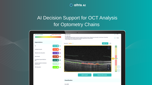 AI for Optometry Chains