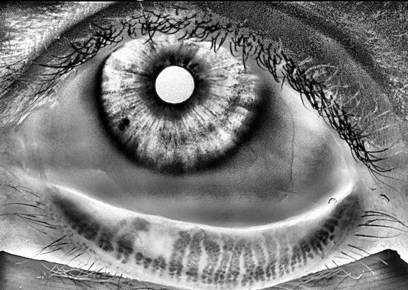 MEA enables rapid, non-invasive visualisation of the meibomian glands at the point of care, supporting earlier detection of meibomian gland dysfunction and dry eye disease.