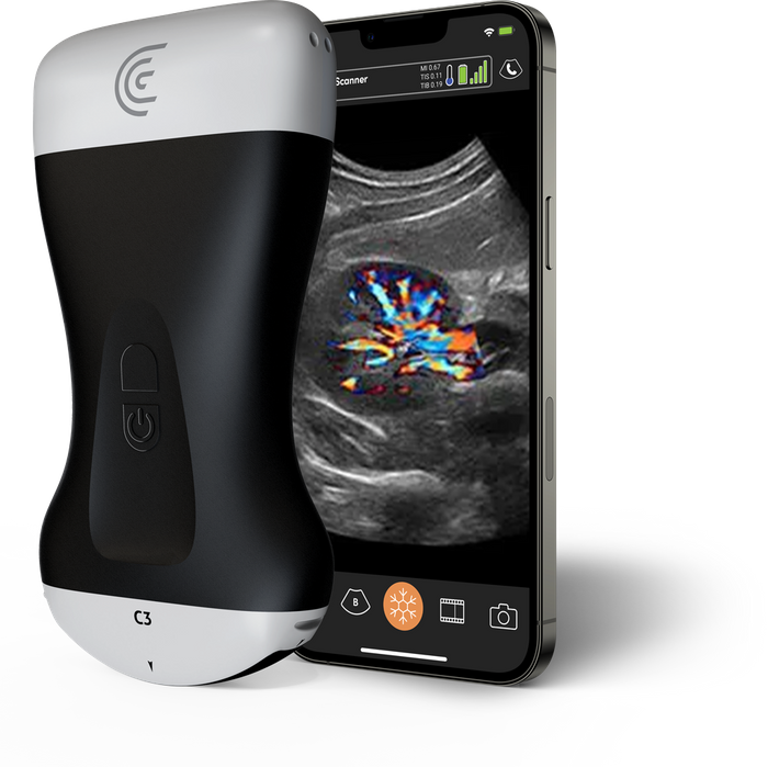Imagex / Clarius HD3 Wireless Ultrasound