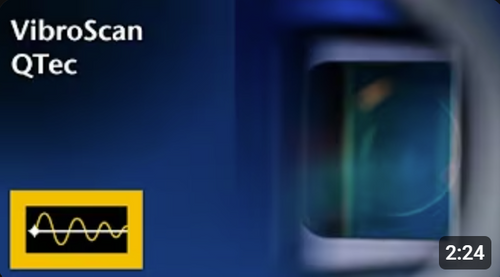 VibroScan QTec – a new class for new ideas