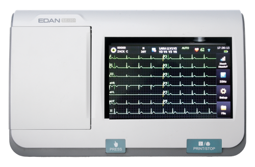 12-Lead ECG Service