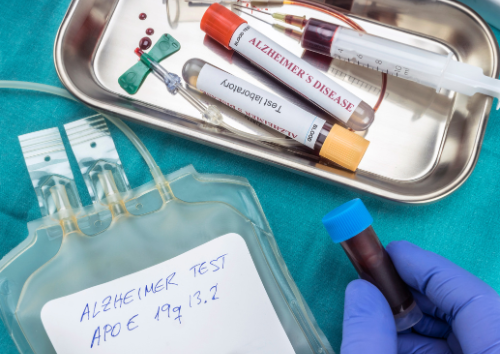 A blood test for Alzheimer’s disease: a five-year project begins
