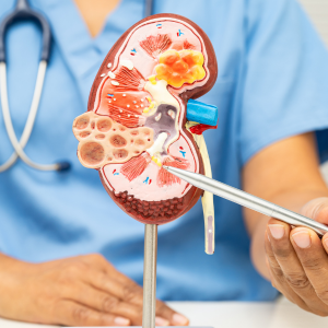 Advances in renal care to take centre stage at landmark healthcare event
