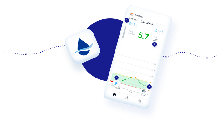 CareSens Air CGM