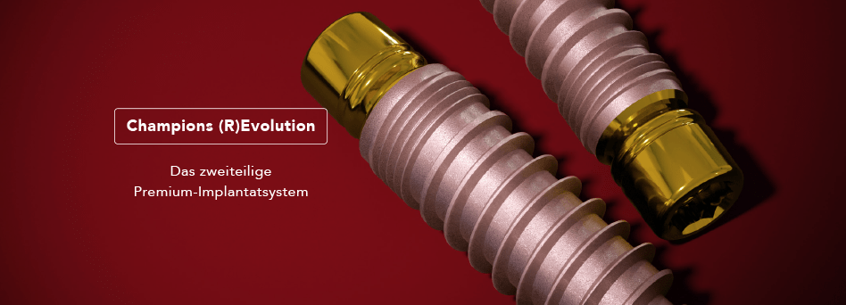 The two-piece CHAMPIONS (R)Evolution ® implant