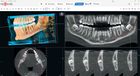 MyRay ProXIma X6