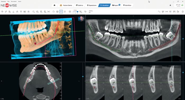 MyRay ProXIma X6