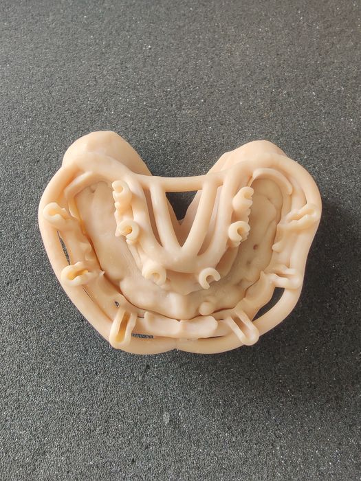 Surgical Guide Open Frame by 2INGIS - Any dental Implant