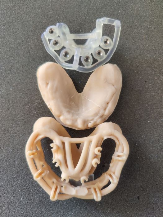 Surgical Guide Open Frame by 2INGIS - Any dental Implant