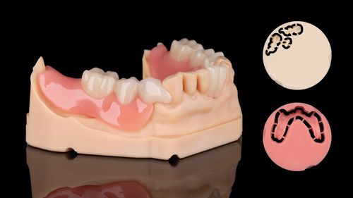 Flexmon® Partials - Metal-free partial dentures reimagined