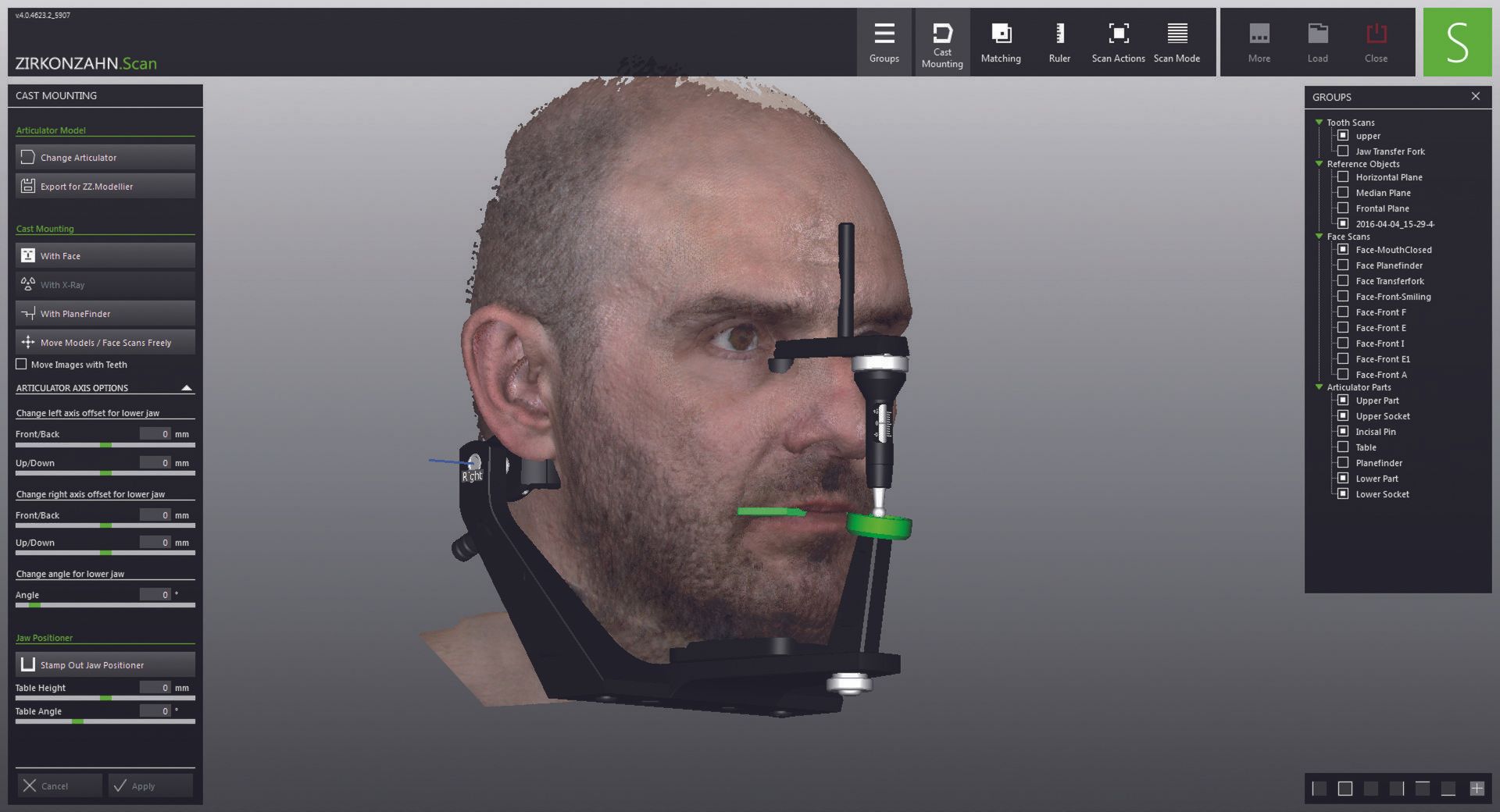 FACE HUNTER The Zirkonzahn facial scanner Dental Technology