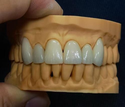 Star Dental Lab