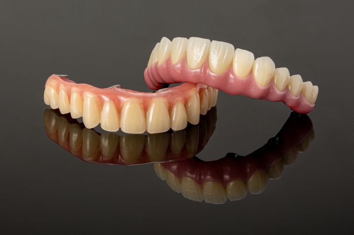 Implant Bar