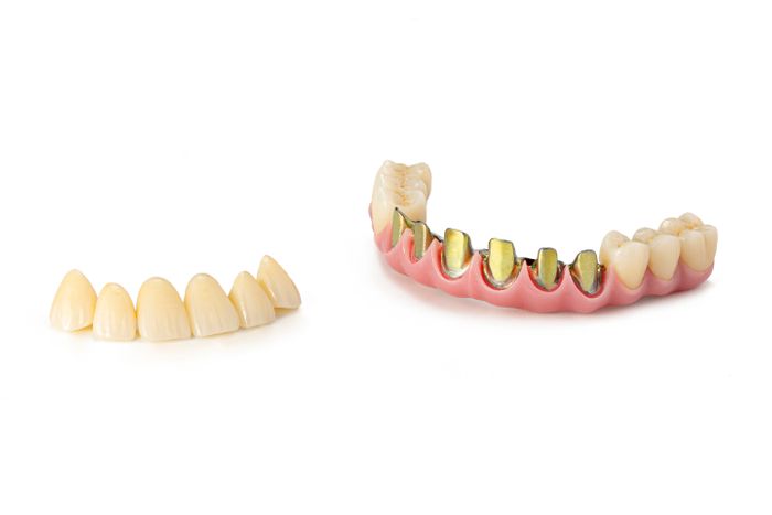 Milled Titanium Implant Bar