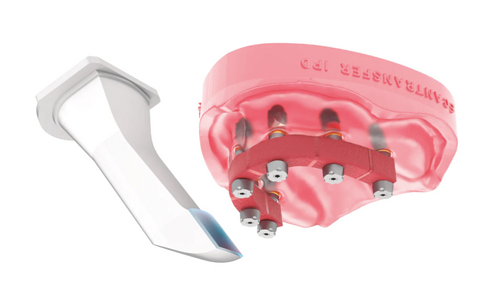 Reducing Uncertainty in the Digital Implant Workflow