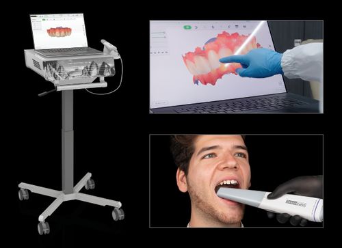 Zirkonzahn's Detection Eye intraoral scanner