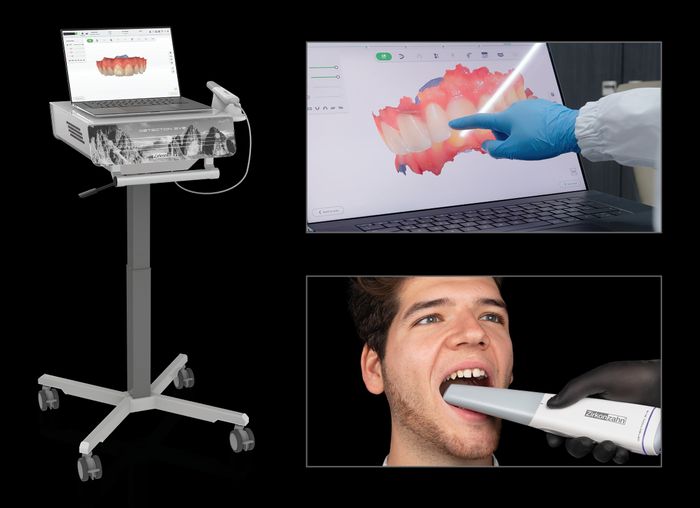 Zirkonzahn's Detection Eye intraoral scanner