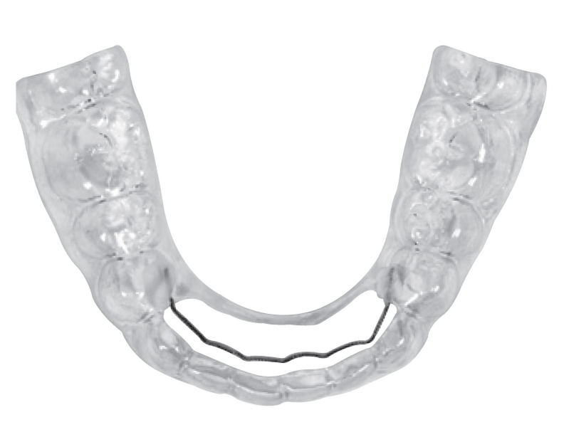 Fix Broken Retainers Simply and Easily with Maintain
