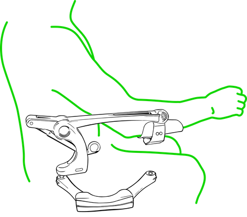 Improved arm function with assistive arm supports  from Rahana Life 