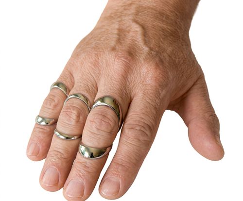 Swanneck Splint 