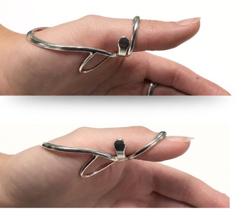 MCP1(+IP) anti-hyperextension splint