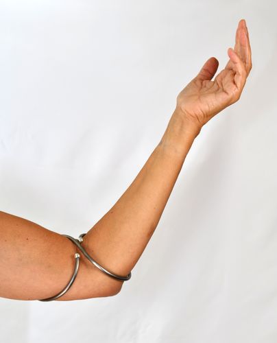 Titanium elbow splint
