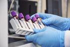 Comprehensive Blood Test Services