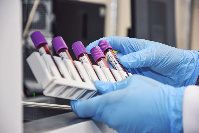 Comprehensive Blood Test Services