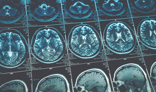 Rewired Digital Imaging conference: speaker and session highlights