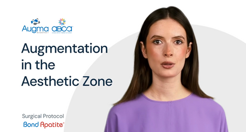 How-to - Augmentation in the Aesthetic Zone