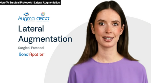 How-To - Lateral Augmentation