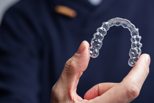Beyond the smile: the impact of clear aligners
