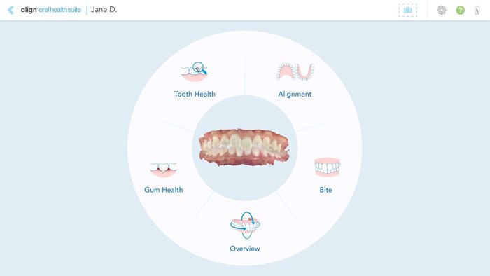 Align Technology Announces iTero™ Intraoral Scanner Product Innovations That Enhance Digital Dentistry Workflows and Integrated Treatment Options in Oral Health, Restorative, and Ortho Treatment in General Dentistry Practices