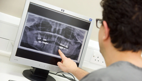 Prosthodontics, MSc