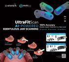UltraFit Scan - full arch resotoration