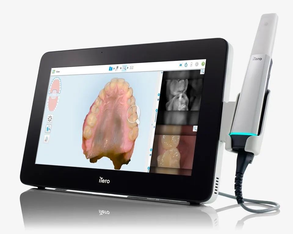 iTero Lumina™ Pro intraoral scanner