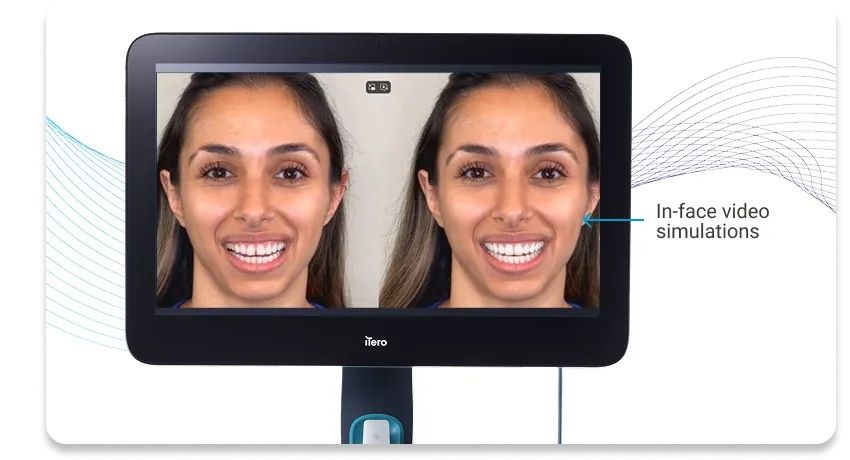 ClinCheck&reg; Smile Video