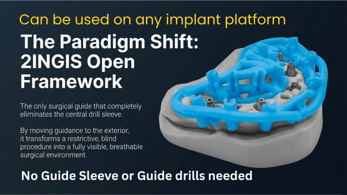 Open Surgical Guide for ANY Implant Platform