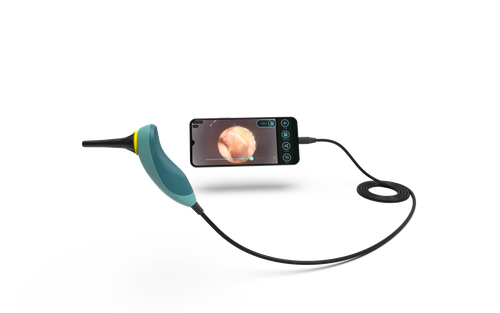 Sibbo digital portable nose and throat diagnostic tools