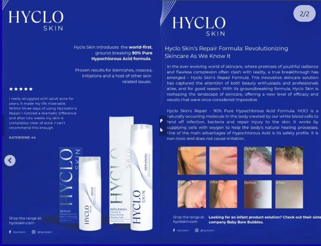 Hyclo Skin repair formula- revolutionizing skincare as we know it