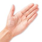 Protek Health Adhesive Wound Closures
