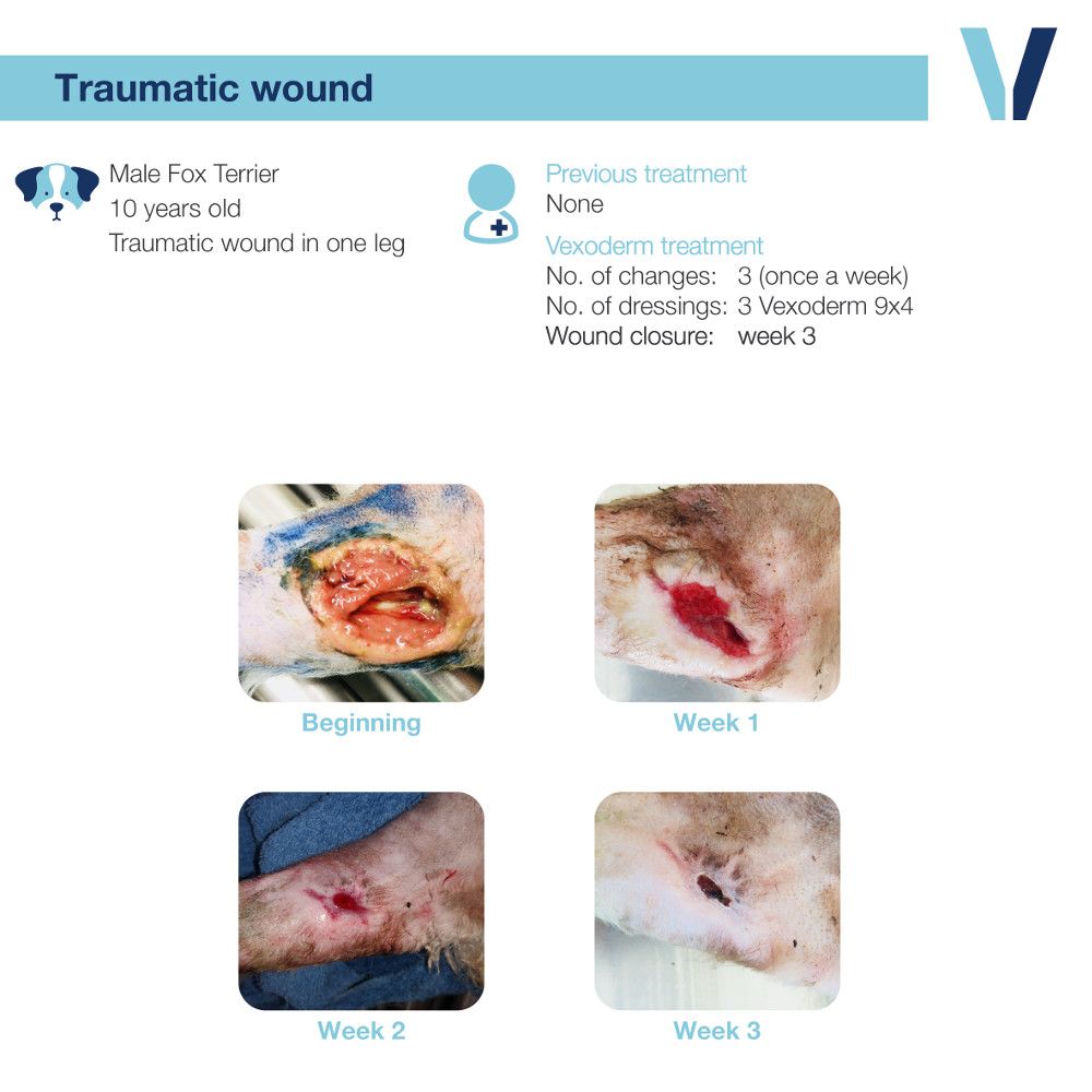 Vexoderm Moist Wound Healing