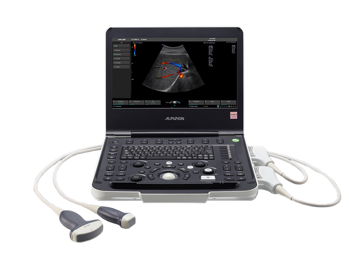 Alpinion Diagnostic Ultrasound