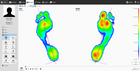 Footscan Pressure Measurement Technology
