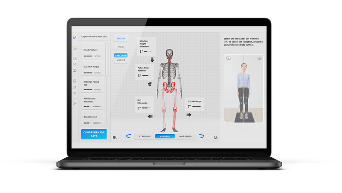 Moti Physio: Revolutionizing AI-Powered 3D Posture & Movement Analysis