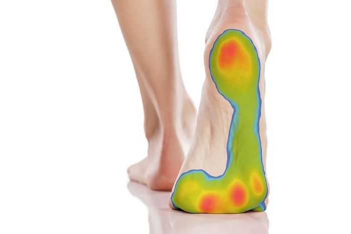 Transform your practise with Foot Pressure Scan