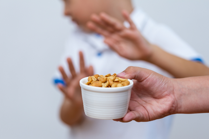Scientists working to ‘reverse’ food allergies with microbiome breakthrough