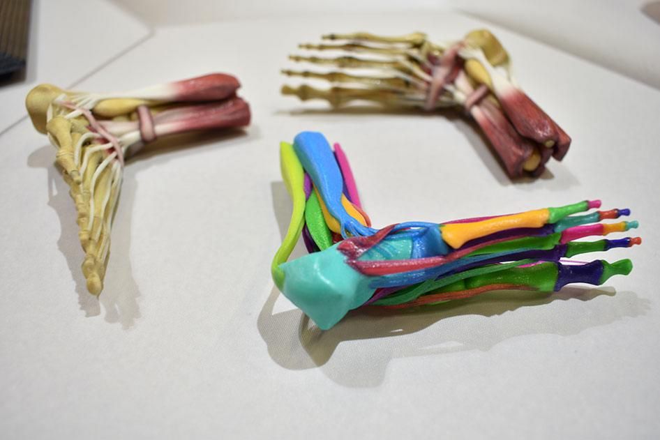 3D Printed Medical Bones