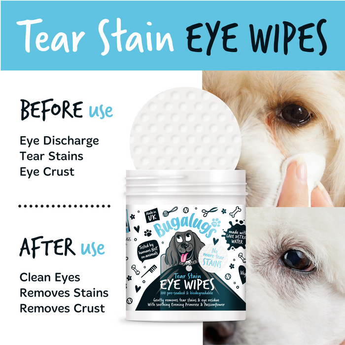 Eye Wipes